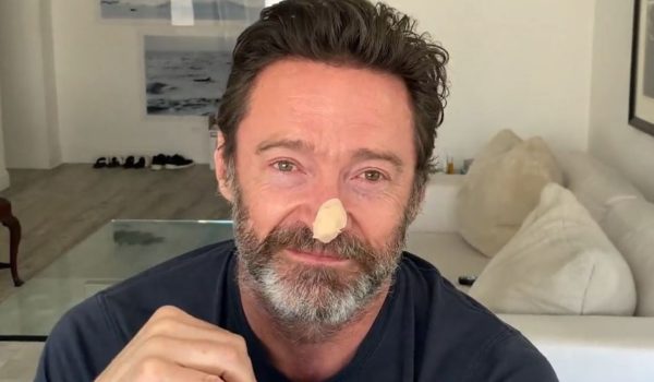 @TheHughJackman / Instagram Hugh Jackman mostró su estado en redes sociales.