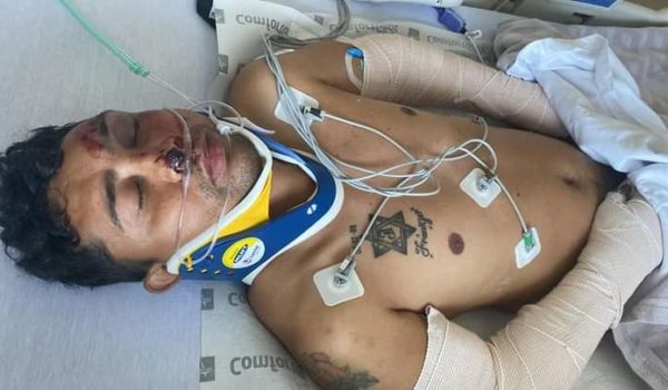 Hermano de ex presa política en estado de gravedad tras sufrir accidente laboral en EE. UU.