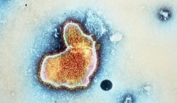Getty Images Imagen del Virus Respiratorio Sincitial o VRS. "Sincitial" se refiere a que el virus destruye membranas celulares por lo que se forman masas con numerosos núcleos celulares llamadas "sincicios".