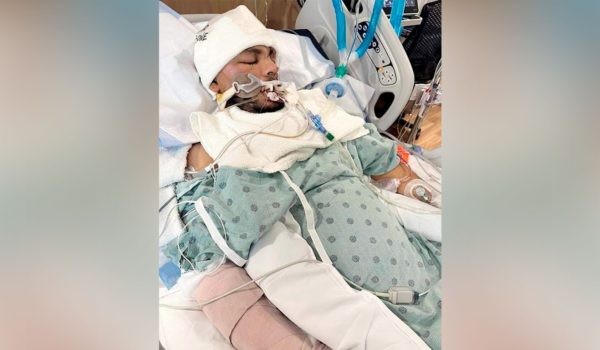 Muere camoapeño en Florida que había sufrido accidente de tránsito hace casi un mes