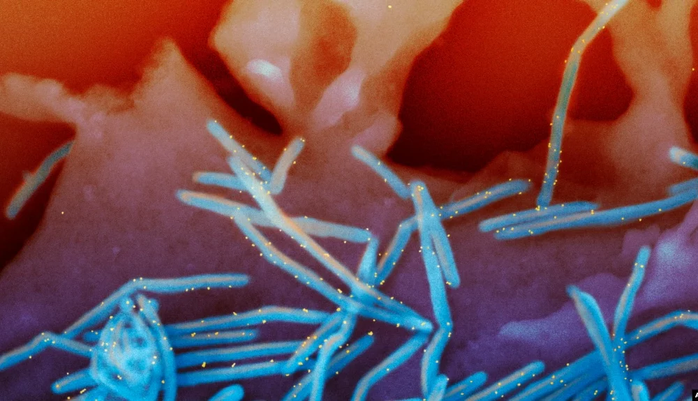 ARCHIVO - Imagen de microscopio electrónico provista por los Institutos Nacionales de Salud muestra viriones del virus respiratorio sincicial humano, coloreados de azul, y anticuerpos proteicos anti-VRS, coloreados de amarillo.