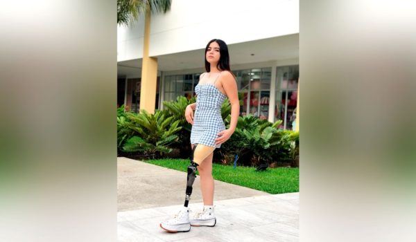 Jenny, la joven que decidió ser modelo después que le amputaron una pierna