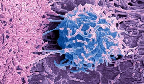 Getty Images Las bacterias y hongos también viven en los tumores.