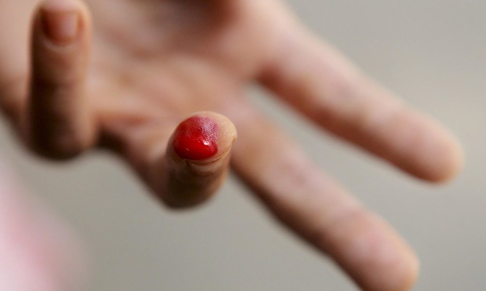 En la imagen de archivo, una india dona sangre para una muestra en una clínica de tratamiento de malaria. EPA/PIYAL ADHIKARY