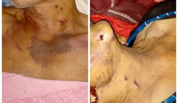 Tercer doble crimen en una semana en Nicaragua. Nuevas víctimas son dos ancianos