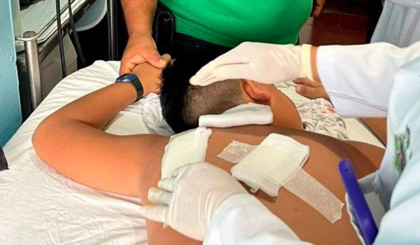 Colegial perfora un pulmón a compañero de clase de diez años en escuela de Condega