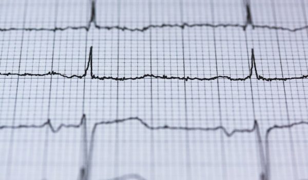 «Sentí como si estuviera sufriendo taquicardias». Alertan sobre el riesgo del consumo de bebidas energizantes