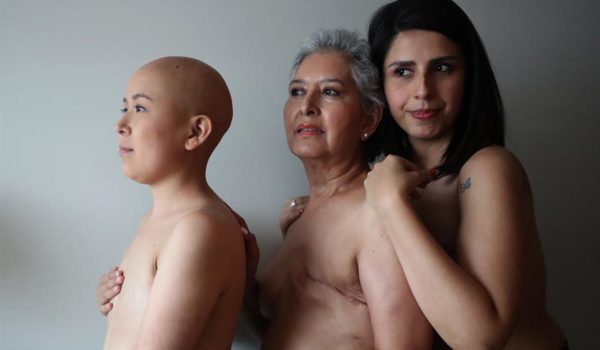 Una de cada 12 mujeres en el mundo desarrollará cáncer de mama, según la OMS