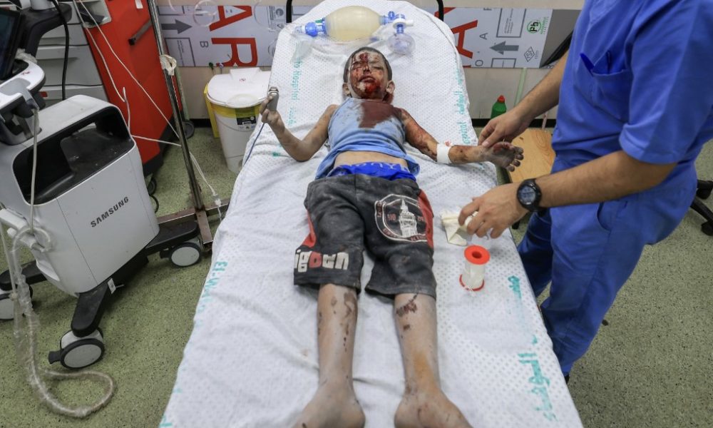 Un menor palestino es atendido por médicos tras resultar herido durante el ataque aéreo contra un hospital en la ciudad de Jan Yunis. LA PRENSA/AFP