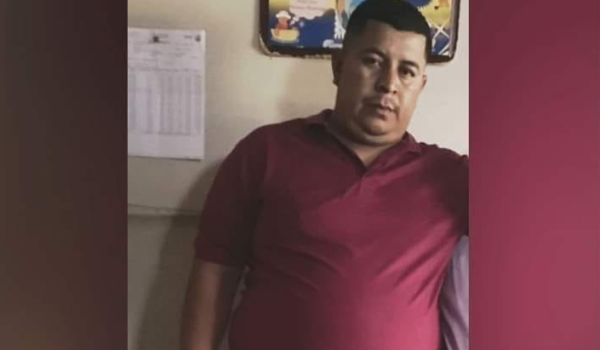 Nicaragüense muere tras someterse a una operación en Texas