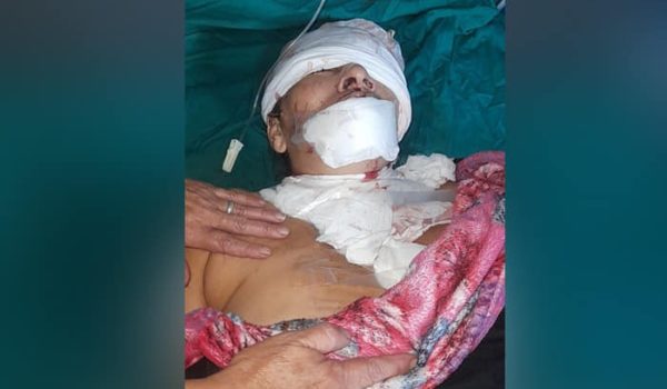 Sujeto le desfigura rostro con trozo de vidrio a esteliana