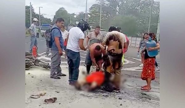 Pareja sufre graves quemaduras al chocar moto contra automóvil en Veracruz