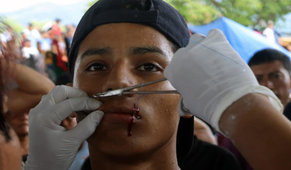 Migrantes se cosen la boca para pedir documentos de tránsito en sur de México