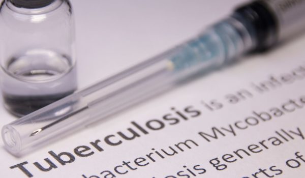 Nicaragua con más casos de tuberculosis en 2023, mientras reduce dosis de vacunación