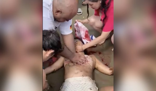 Joven es impactada mortalmente por una panga en San Juan del Sur