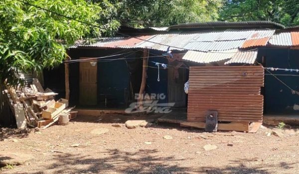 Nicaragüense es quemado en el rostro con aceite por su pareja en Costa Rica