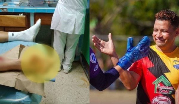 Bus que trasladaba a equipo de futbol se accidenta dejando un jugador fracturado y varios lesionados