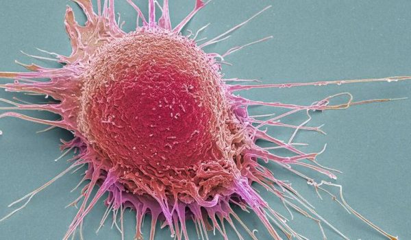 Diez datos sorprendentes que probablemente no sabías sobre el cáncer 