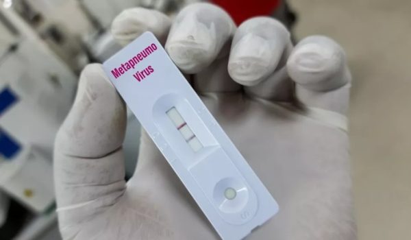 OMS descarta brote de infecciones respiratorias que impliquen riesgo de una nueva pandemia