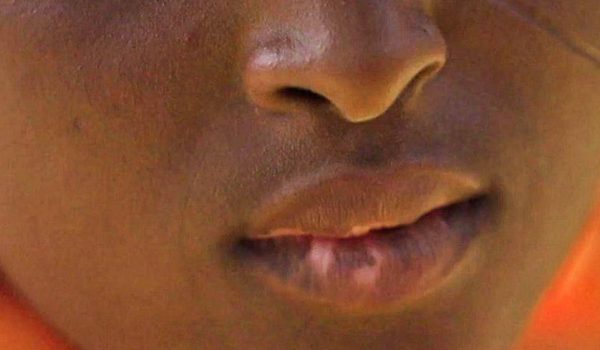 «Llené de cicatrices a mis 6 hijos al utilizar cremas para aclarar sus pieles»: la epidemia de «decoloración» que llevó a Nigeria a declarar el estado de emergencia