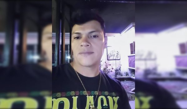 Hombre quema con sustancia química a su expareja en Costa Rica