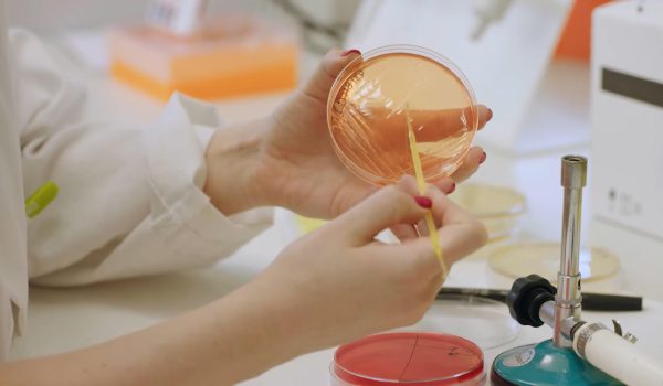 Los efectos de una bacteria intestinal sobre la inmunidad innata abren nueva vía para prevenir la obesidad