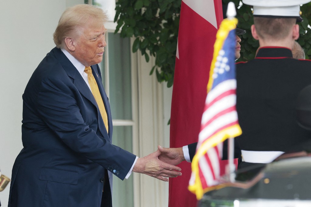Donald Trump, insuficiencia venosa