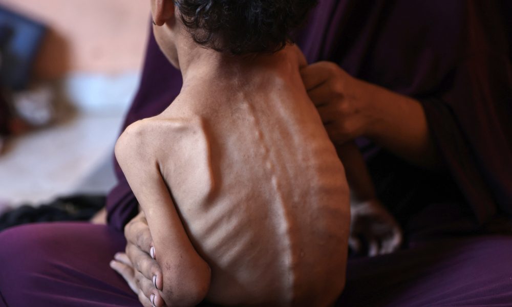 Gaza, hambruna