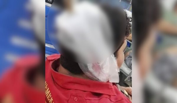 Un bombero resulta con una varilla de cuete incrustada en la cabeza en celebración de Santo Domingo