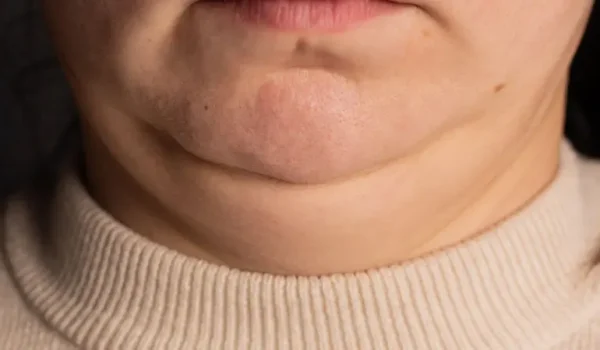 Si tu cuello se ve más grueso o más delgado de lo habitual, puede indicar algunos problemas de salud.