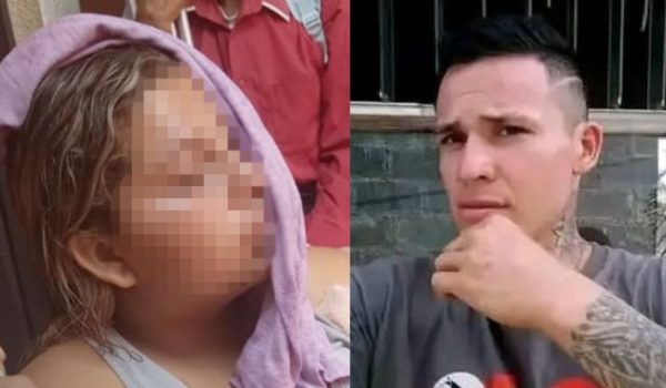 Femicidio frustrado en Jinotepe: joven sobrevive tras recibir varias puñaladas a manos de su pareja