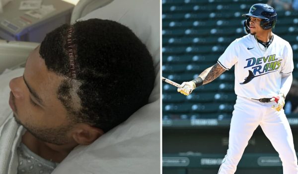 Prospecto de los Rays de Tampa Bay revela una cirugía cerebral que le salvó la vida