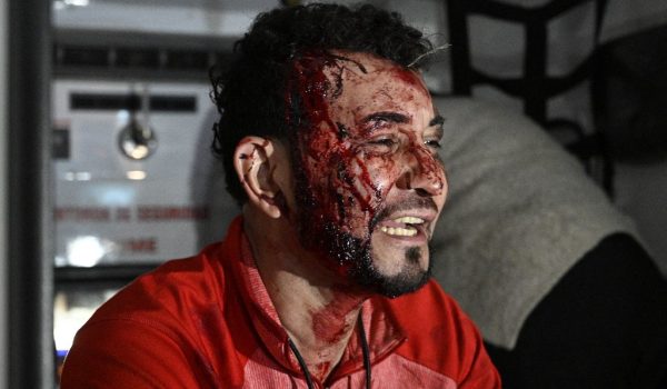 Violenta acción policial para suprimir protesta por resultados electorales en Honduras deja ocho heridos