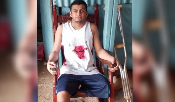 «Con la prótesis tengo la esperanza de volver a caminar»: la historia de Milton Lagos quien perdió su pierna trabajando