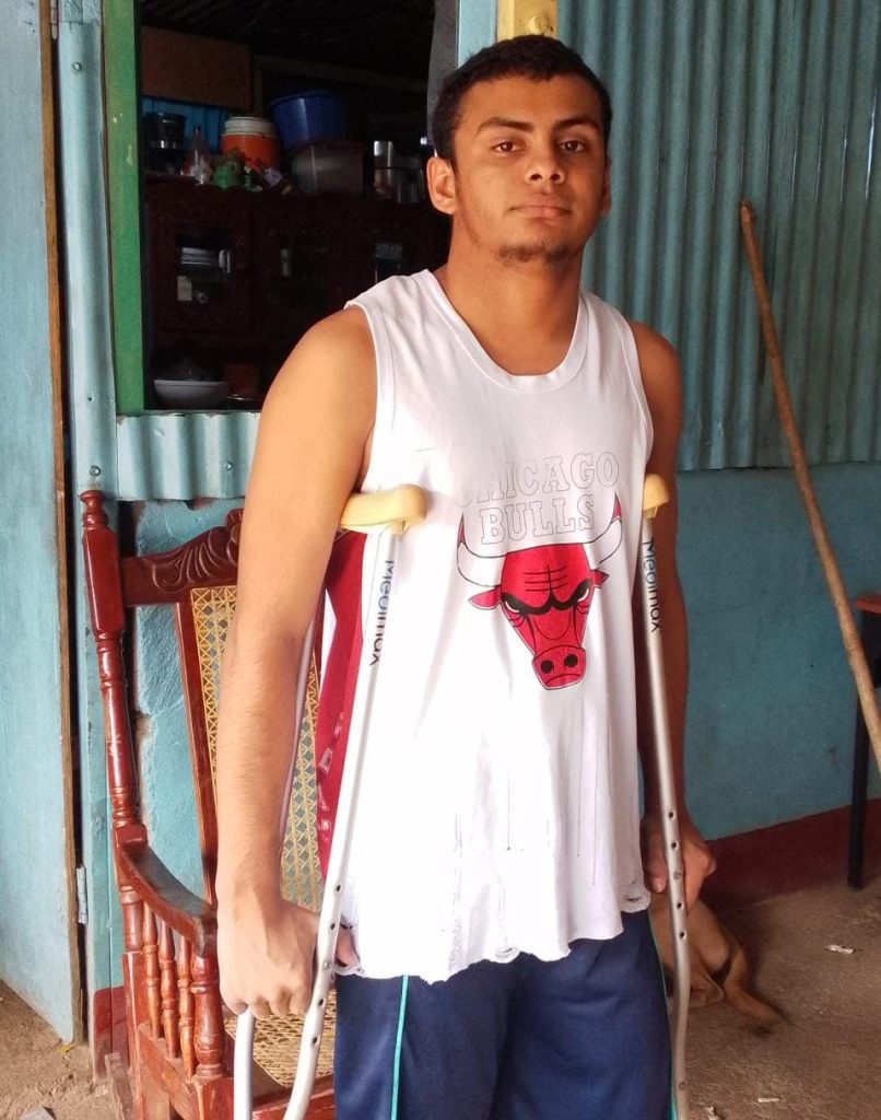 Milton José Lagos Rivera, de 20 años, quien sueña con volver a caminar tras perder su pierda en un accidente laboral. Foto: Cortesía.