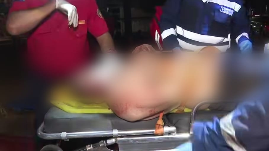 Paramédicos trasladan al capitalino Fred José Ulloa, de 38 años, que fue agredido en Linda Vista. Foto: captura de video de Canal 10.