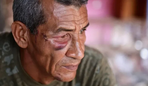 El impacto del misil lanzó a Wilman González contra la pared. Su tía, Rosa, perdió la vida.