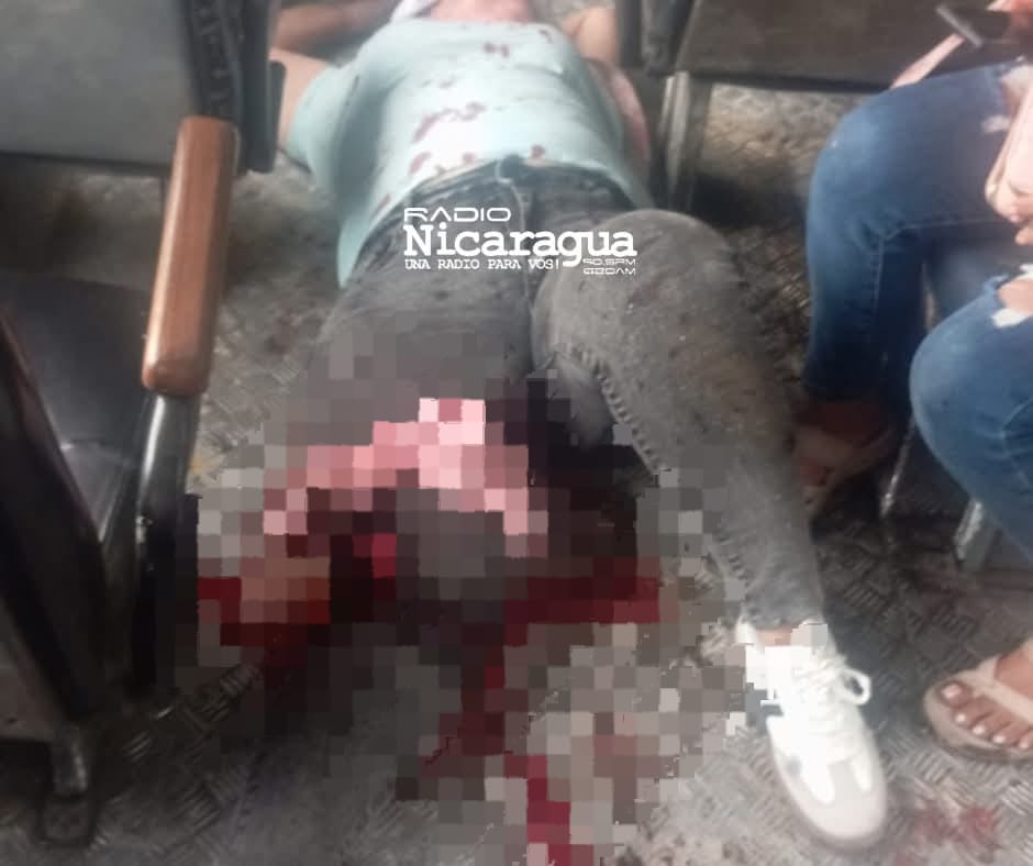 Una mujer herida en su rodilla derecha en violento accidente de tránsito en la rotonda de Nindirí.