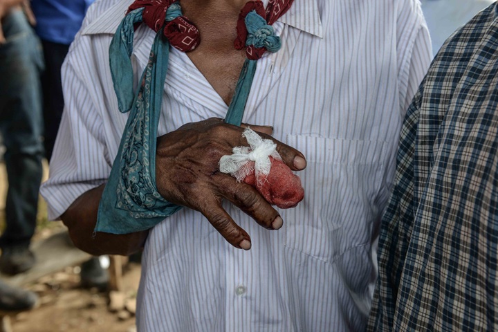 Decenas de campesinos de El Tule resultaron heridos el 24 de diciembre de 2014, a manos de la Policía de los Ortega Murillo. LA PRENSA/ ARCHIVO/ ÓSCAR NAVARRETE