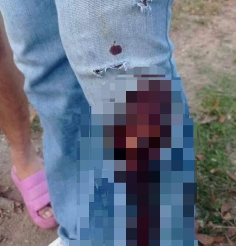 Sandra Isabel Rizo Castillo fue violentamente atacada por perros pitbull en Dipilto. Foto: Canal Veintiseis Nicaragua/facebook.