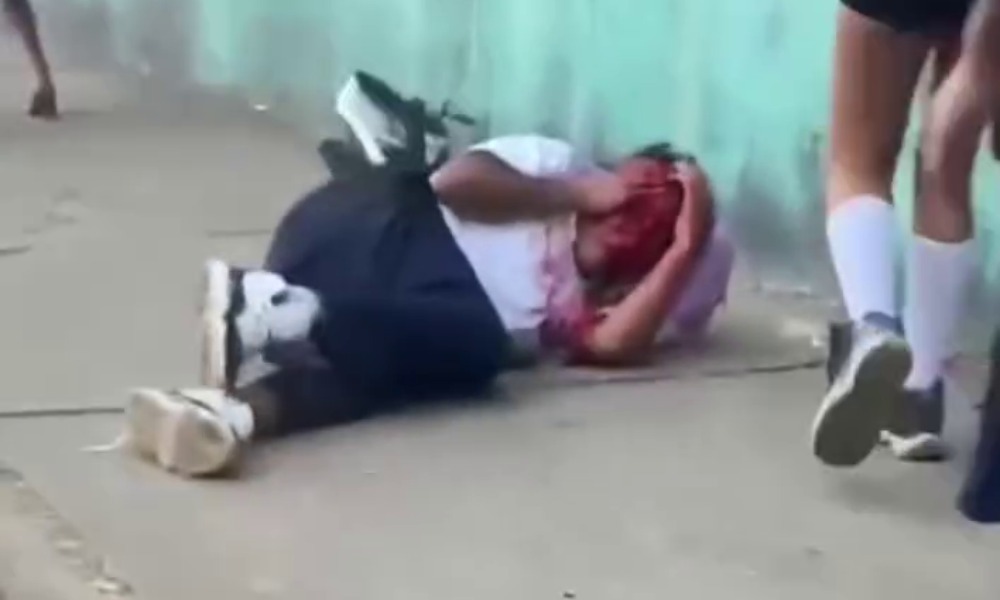 Adolescente recibe golpiza en las afueras de su colegio en Chichigalpa