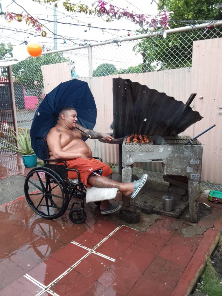 La recuperación de Garvin Pérez, habitante de Managua, es larga y dolorosa