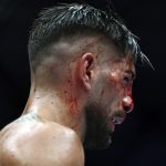 Este el estado de salud de Ilia Topuria después de la paliza sufrida en el UFC 250