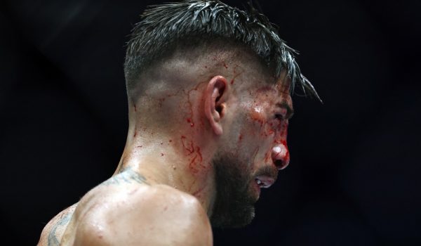 Este el estado de salud de Ilia Topuria después de la paliza sufrida en el UFC 250