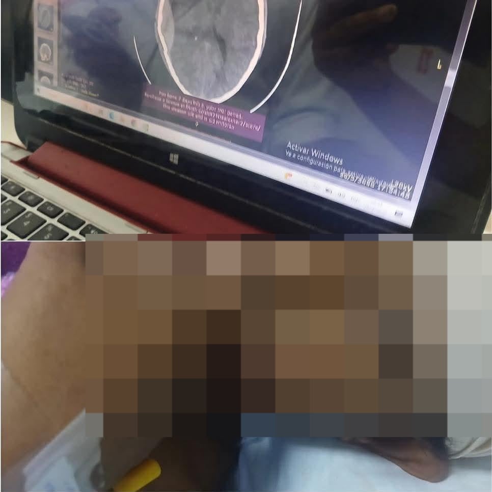 Niño gravemente herido en Hospital de Estelí. Foto: Canal TV Estelí/facebook.