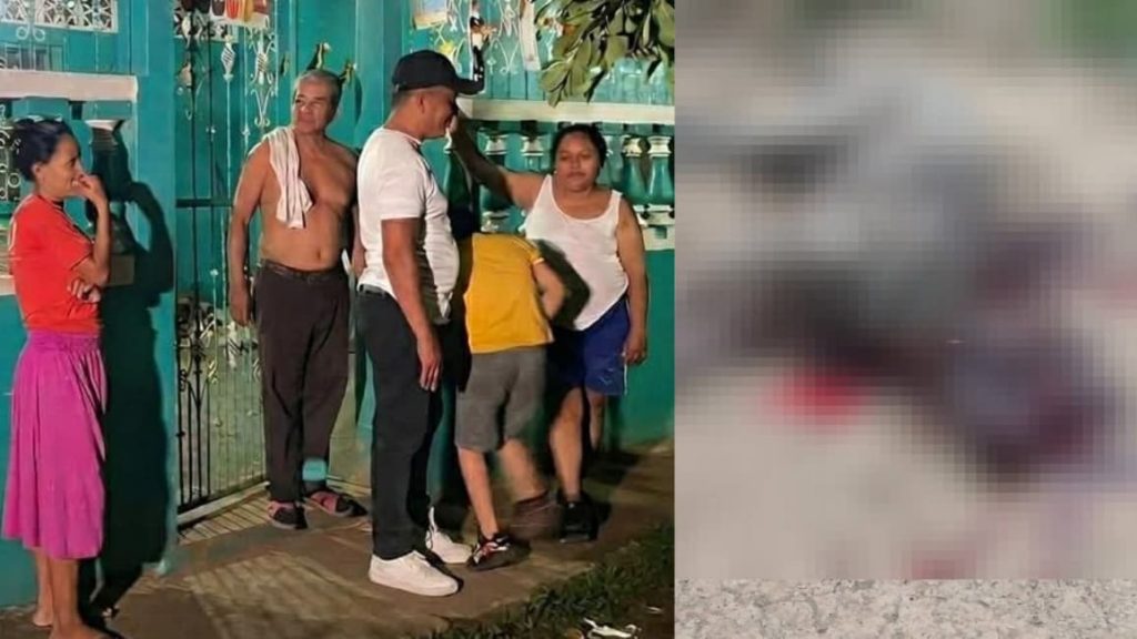 Niña de un año resulta grave tras ataque de perro pitbull en Masaya. Foto: Canla 8/Facebook/Masaya al instante.