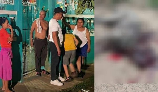 Bebé de un año continúa grave tras brutal ataque de pitbull en su propia casa en Masaya