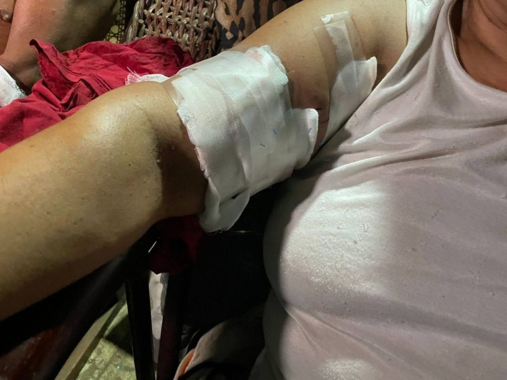 Abuela resulta lesionada al defender a su nieta de un año que terminó grave tras ataque de perro pitbull en Masaya. Foto: Facebook/Masaya al instante.