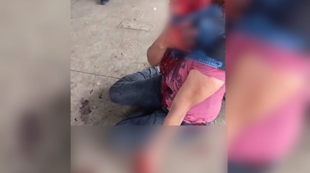 Brenda López bañada en sangre tras ser agredida por su actual pareja. Foto: Cortesía.