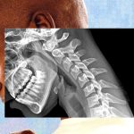 «Cuerpo de teléfono»: cómo la tecnología nos arruga el cuello y debilita las manos